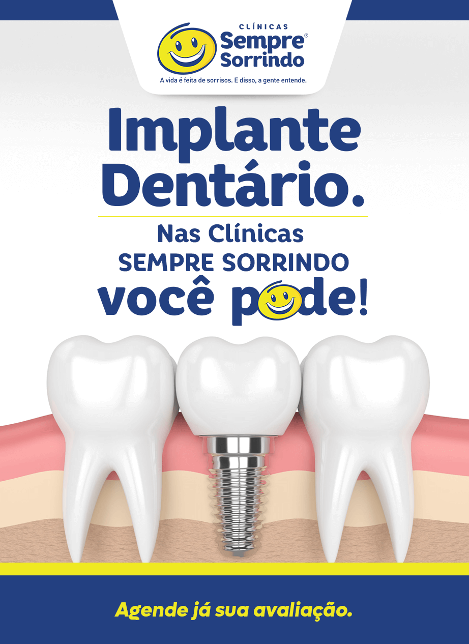 Implante Dentário na Clínica Sempre Sorrindo
