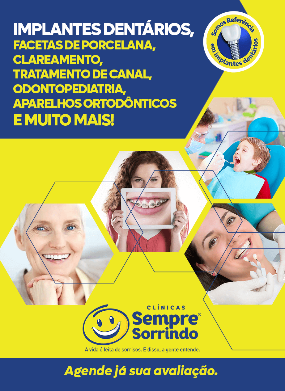 Implantes Dentários, Facetas de Porcelana, Clareamentoe muito mais na Clinica Sempre Sorrindo